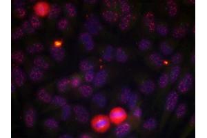 Immunofluorescence staining of methanol-fixed HeLa cells using Elk-1 (phospho-Thr417) antibody. (ELK1 antibody  (pThr417))