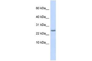 Western Blotting (WB) image for anti-Cystatin 9 (Testatin) (CST9) antibody (ABIN2458862)