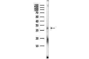 anti-Gap Junction Protein, beta 3, 31kDa (GJB3) (C-Term) antibody