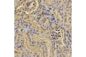 Immunohistochemistry (IHC) image for anti-Proteasome (Prosome, Macropain) 26S Subunit, Non-ATPase, 9 (PSMD9) antibody (ABIN1876545) (PSMD9 antibody)