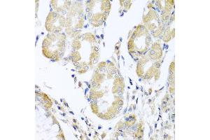 Immunohistochemistry of paraffin-embedded human stomach using ACAD9 antibody at dilution of 1:100 (x40 lens). (ACAD9 antibody)