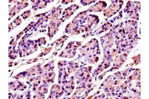 Immunohistochemistry of paraffin-embedded human pancreatic tissue using ABIN7168925 at dilution of 1:100 (SPINK1 antibody  (AA 19-79))