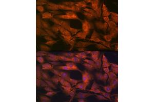 Immunofluorescence analysis of C6 cells using Laminin beta 1 Rabbit mAb (ABIN7268185) at dilution of 1:100 (40x lens). (Laminin beta 1 antibody)