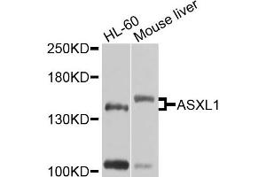 Western blot analysis of extracts of various cells, using ASXL1 antibody. (ASXL1 antibody)