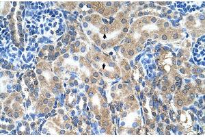Rabbit Anti-ABP1 Antibody ,Paraffin Embedded Tissue: Human Kidney  Cellular Data: Epithelial cells of renal tubule  Antibody Concentration: 4.