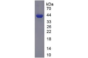 SDS-PAGE analysis of Human PFKL Protein.
