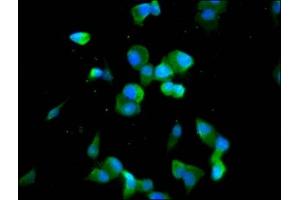 Immunofluorescence staining of SH-SY5Y cells with ABIN7148040 at 1:100, counter-stained with DAPI. (Codanin 1 (CDNA1) (AA 62-249) antibody)