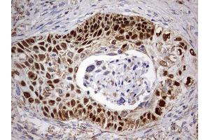 Immunohistochemistry (IHC) image for anti-Tumor Protein P63 (TP63) antibody (ABIN2673817) (p63 antibody)