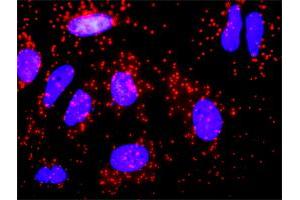 Proximity Ligation Analysis of protein-protein interactions between CALR and F8. (Factor VIII antibody  (AA 213-312))