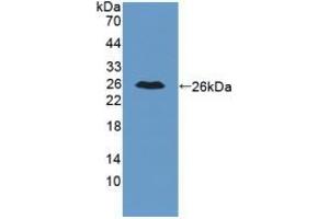 Detection of Recombinant IL34, Mouse using Polyclonal Antibody to Interleukin 34 (IL34) (IL-34 antibody  (AA 21-235))