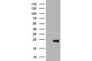 HEK293T cells were transfected with the pCMV6-ENTRY control (Left lane) or pCMV6-ENTRY PEBP1 (Right lane) cDNA for 48 hrs and lysed. (PEBP1 antibody)