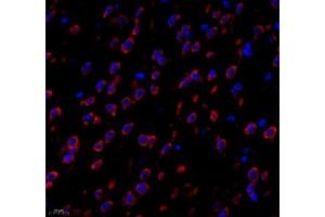 Immunofluorescence of paraffin embedded mouse brain using PTPN12 (ABIN7075292) at dilution of 1: 1000 (400x lens) (PTPN12 antibody)