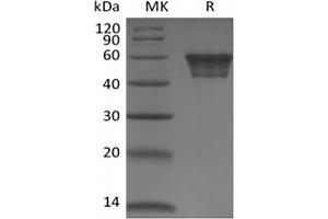 Western Blotting (WB) image for CD82 (CD82) protein (Fc Tag) (ABIN7319825) (CD82 Protein (CD82) (Fc Tag))