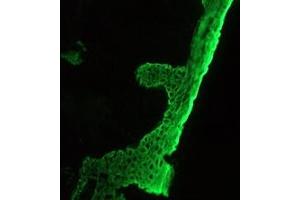 Image no. 2 for anti-pan Keratin (panKRT) antibody (ABIN959483) (pan Keratin antibody)
