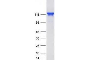 Western Blotting (WB) image for Tight Junction Protein 3 (Zona Occludens 3) (TJP3) protein (Myc-DYKDDDDK Tag) (ABIN2733730)