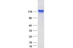 Validation with Western Blot (TJP3 Protein (Myc-DYKDDDDK Tag))