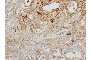 Immunohistochemistry (IHC) image for anti-Adrenergic, Beta, Receptor Kinase 1 (ADRBK1) (C-Term) antibody (ABIN2855125)