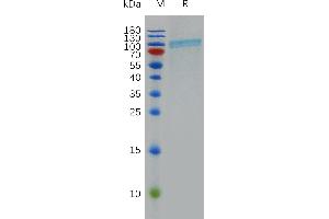 Human CD39 Protein, hFc Tag on SDS-PAGE under reducing condition. (CD39 Protein (AA 40-476) (Fc Tag))