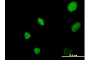 Immunofluorescence of purified MaxPab antibody to YEATS4 on HeLa cell. (GAS41 antibody  (AA 1-227))