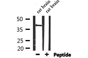 Western blot analysis of extracts from rat brain, using CYSLTR1 Antibody. (CysLTR1 antibody  (Internal Region))