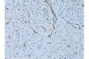 Immunohistochemistry of paraffin-embedded human uterus using SELE Antibody. (Selectin E/CD62e antibody  (AA 22-230))