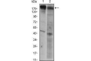 Western blot analysis using EGFR mouse mAb against A431 (1) AND Hela (2) cell lysate.