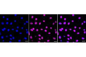 Immunocytochemical staining of C2C12 cells with Histone H2B (acetyl K20) antibody (ABIN7798944), 1:1,000).