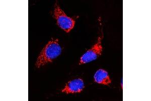 IF analysis of ACACA using anti-ACACA antibody (ABIN7601254). (Acetyl-CoA Carboxylase alpha antibody  (AA 31-2336))