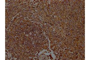 IHC image of ABIN7156538 diluted at 1:100 and staining in paraffin-embedded Human spleen tissue performed on a Leica BondTM system. (ICAM-3/CD50 antibody  (AA 200-547))