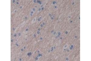 #VALUE! (LARGE antibody  (AA 25-178))