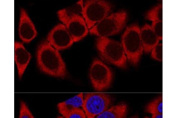 RPL36AL antibody