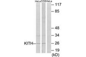 Western blot analysis of extracts from HeLa/COS7 cells, using KITH Antibody. (TK1 antibody  (AA 161-210))