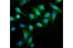 IF analysis of MIEF1 using anti-MIEF1 antibody (ABIN7600396). (SMCR7L antibody  (AA 189-463))