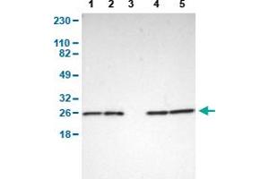 Western Blot analysis of (1) human cell line RT-4, (2) human cell line U-251MG sp, (3) human plasma (IgG/HSA depleted), (4) human liver tissue, and (5) human tonsil tissue. (PARK7/DJ1 antibody  (AA 40-177))