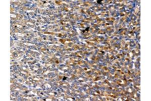 ABIN6260715 and ABIN6278829 at 1/100 staining rat stomach tissue by IHC-P. (CDK5RAP1 antibody  (C-Term))