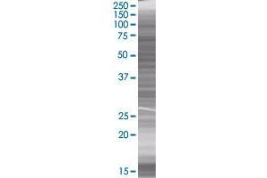 Western Blotting (WB) image for RPA3 293T Cell Transient Overexpression Lysate(Denatured) (ABIN1333342)