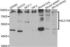 Western blot analysis of extracts of various cell lines, using SLC1A5 antibody. (SLC1A5 antibody)