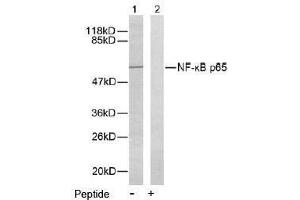 Image no. 2 for anti-Nuclear Factor-kB p65 (NFkBP65) (Ser276) antibody (ABIN197111) (NF-kB p65 antibody  (Ser276))