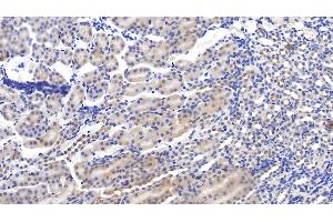 Detection of C1INH in Mouse Kidney Tissue using Polyclonal Antibody to Complement 1 Inhibitor (C1INH) (SERPING1 antibody  (AA 397-495))