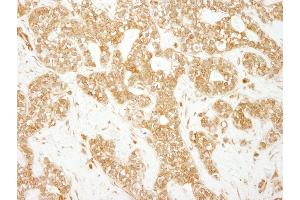 Immunohistochemistry (IHC) image for anti-Early Endosome Antigen 1 (EEA1) (AA 100-150) antibody (ABIN7454791) (EEA1 antibody  (AA 100-150))
