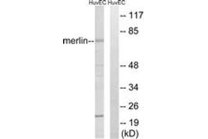 Western blot analysis of extracts from HuvEc cells, treated with IFN-alpha 1000U/ml 18h, using Merlin (Ab-518) Antibody. (Merlin antibody  (AA 485-534))