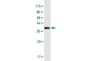 Western Blot detection against Immunogen (36. (MYO1E antibody  (AA 918-1014))