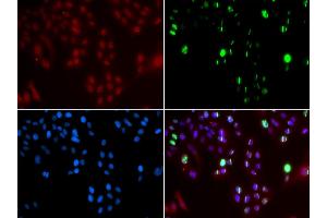 Immunofluorescence analysis of GFP-RNF168 transgenic U2OS cell using FANCD2 antibody. (FANCD2 antibody  (AA 1-230))