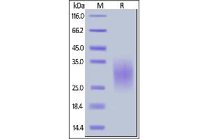 SDS-PAGE (SDS) image for Tumor Necrosis Factor Receptor Superfamily, Member 10b (TNFRSF10B) (AA 53-180) (Active) protein (His tag) (ABIN6809883)