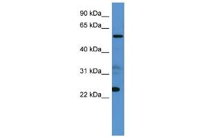 WB Suggested Anti-CPNE9 Antibody Titration: 0. (CPNE9 antibody  (C-Term))