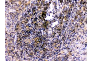 Anti-TLR7 antibody, IHC(P) IHC(P): Rat Spleen Tissue (TLR7 antibody  (C-Term))
