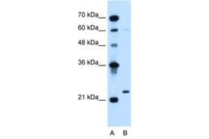 Image no. 1 for anti-Immunoglobulin lambda-Like Polypeptide 1 (IGLL1) (AA 64-113) antibody (ABIN204998)