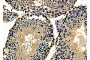 ABIN6264007 and ABIN6277984 at 1/100 staining Mouse testis tissue by IHC-P. (Poly(A) Binding Protein, Cytoplasmic, Pseudogene 2 (PABPCP2) (C-Term) antibody)