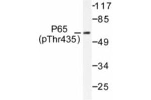 Image no. 1 for anti-Nuclear Factor-kB p65 (NFkBP65) (pThr435) antibody (ABIN318087) (NF-kB p65 antibody  (pThr435))