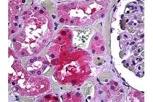 Anti-GALT antibody IHC of human kidney, tubules. (GALT antibody  (AA 1-380))